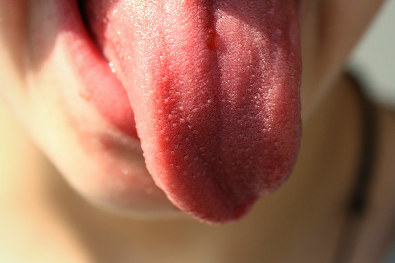 sleep apnea fat tongues