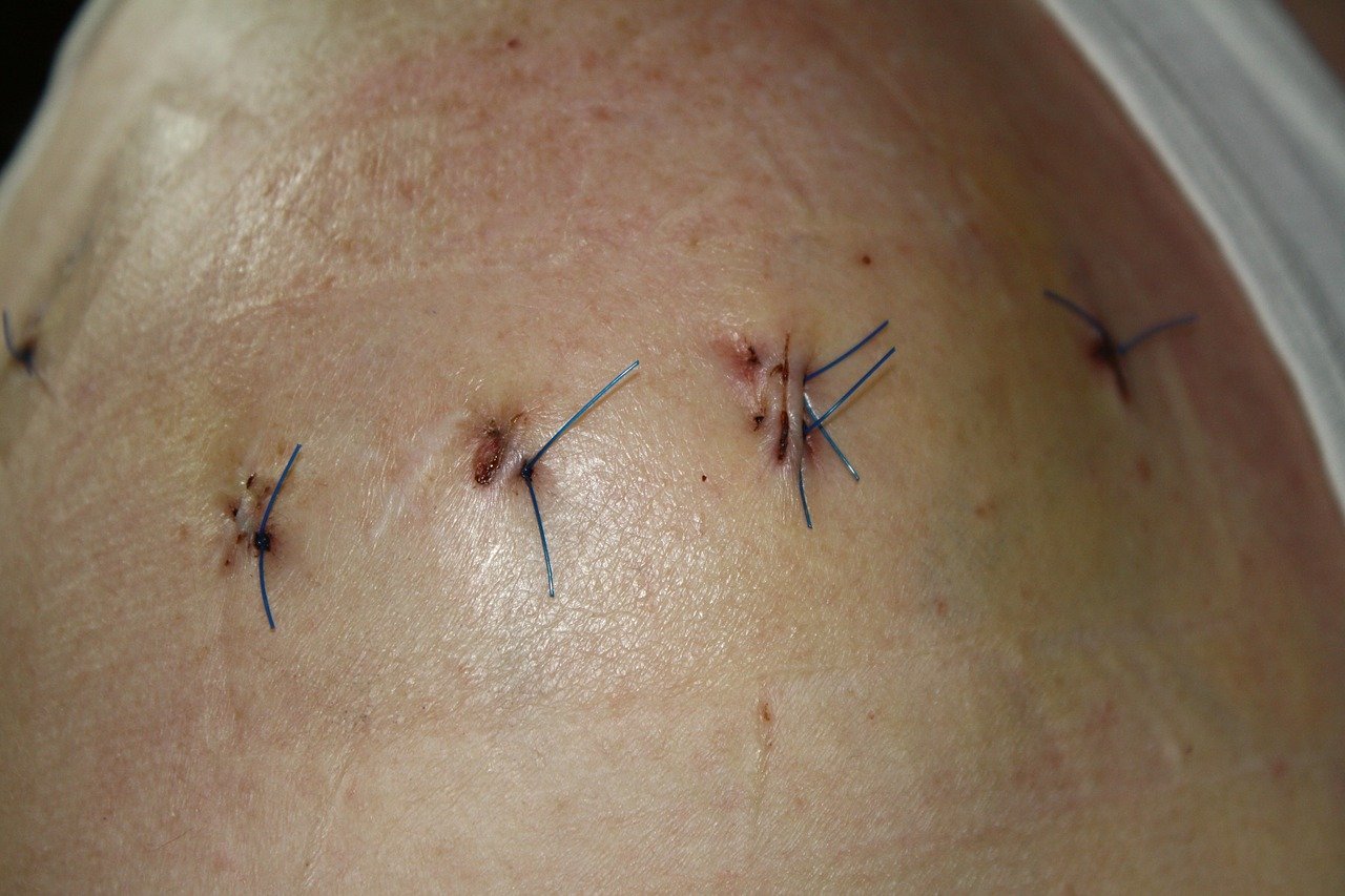 human skin yarn stitch up wounds